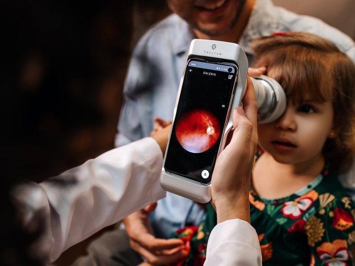 Retinografia digital sendo realizada em paciente pediátrico